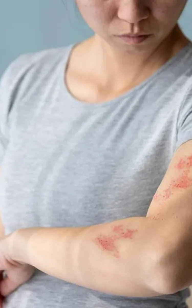 skin irritation - sfd